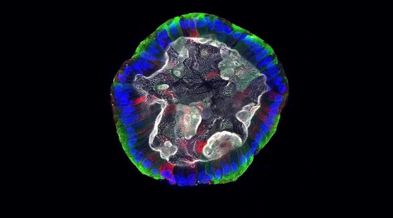 Differentiated Intestinal Organoid